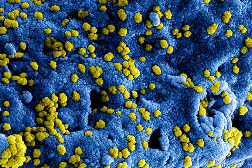 coronavirus coronavirus